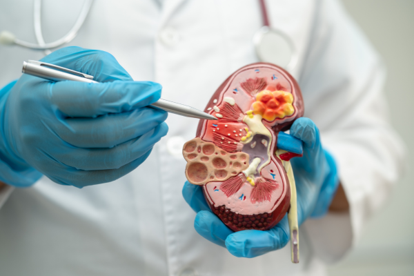 Team-Based Nephrology Care